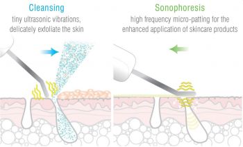 ULTRASONIC FACIAL